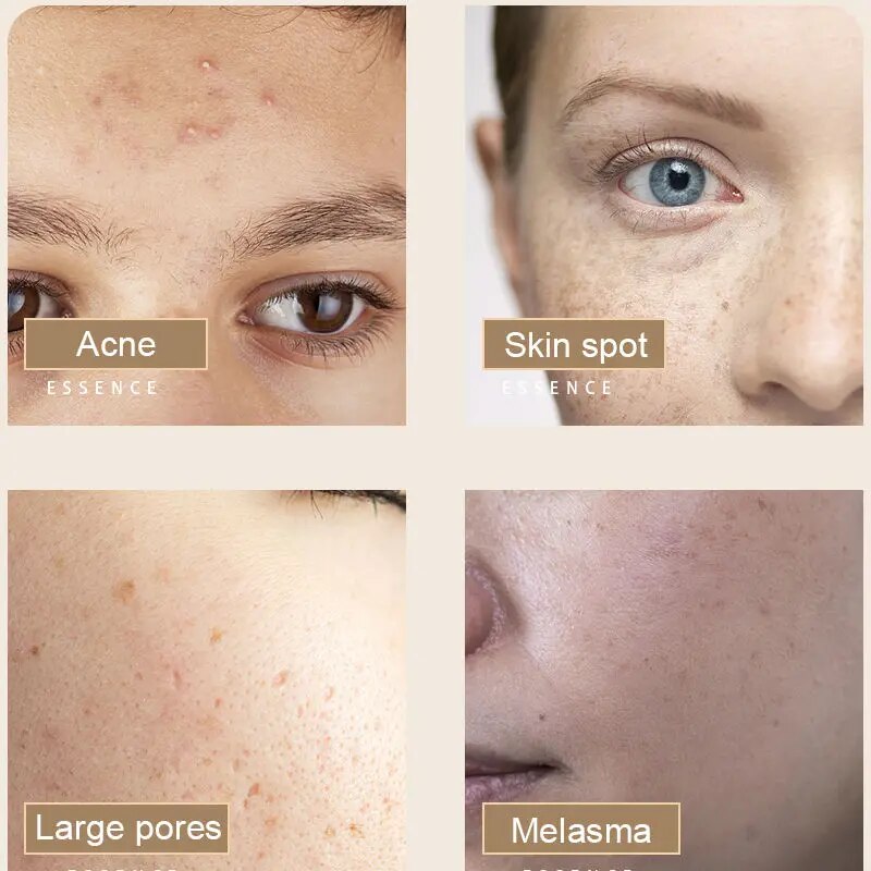 Dimollaure Snail Serum Hyaluronic Acid Essence Face Cream Moisturizing Acne Treatment Skin Care Repair Whitening Anti-Aging